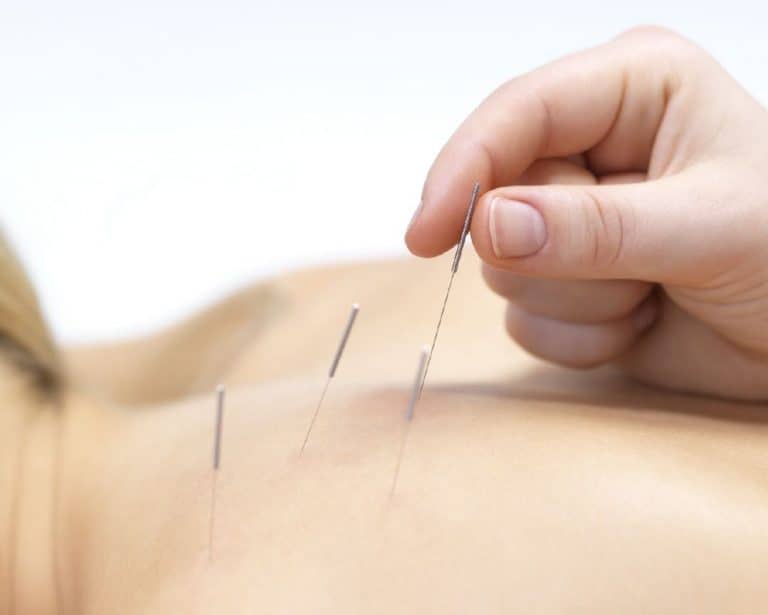 tratamientos de acupuntura para controlar el asma